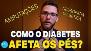 COMO O DIABETES AFETA OS PÉS? *PÉ DIABÉTICO*