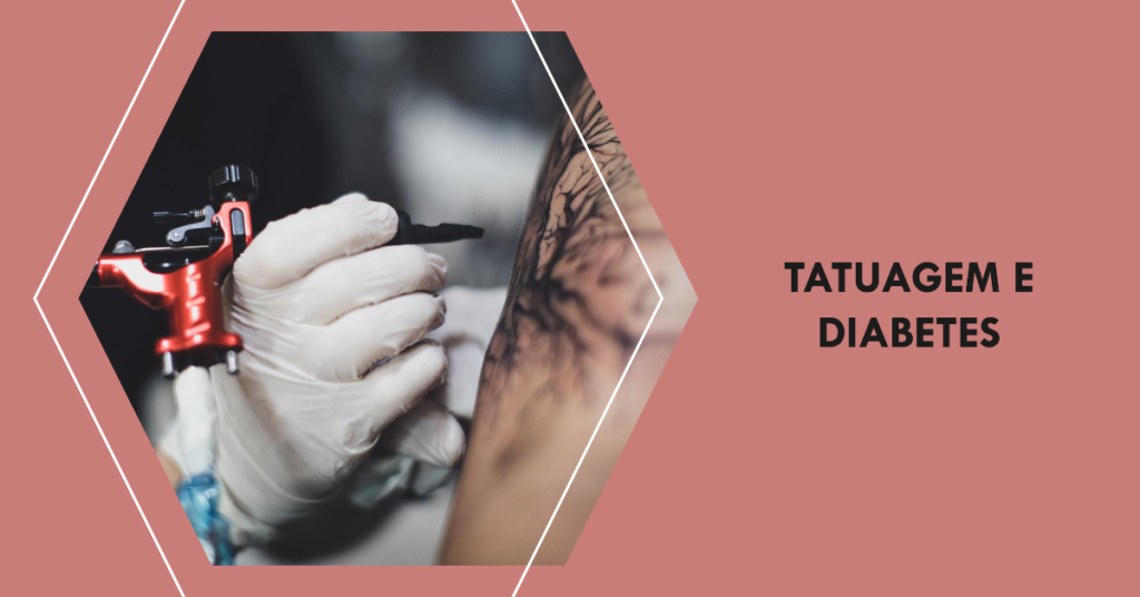 Quem tem diabetes pode fazer tatuagem? Quem tem diabetes pode fazer tatuagem?