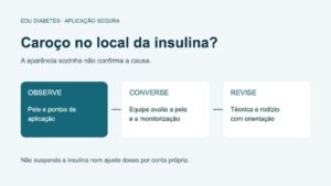 Caroço no local da insulina: pode ser lipohipertrofia?