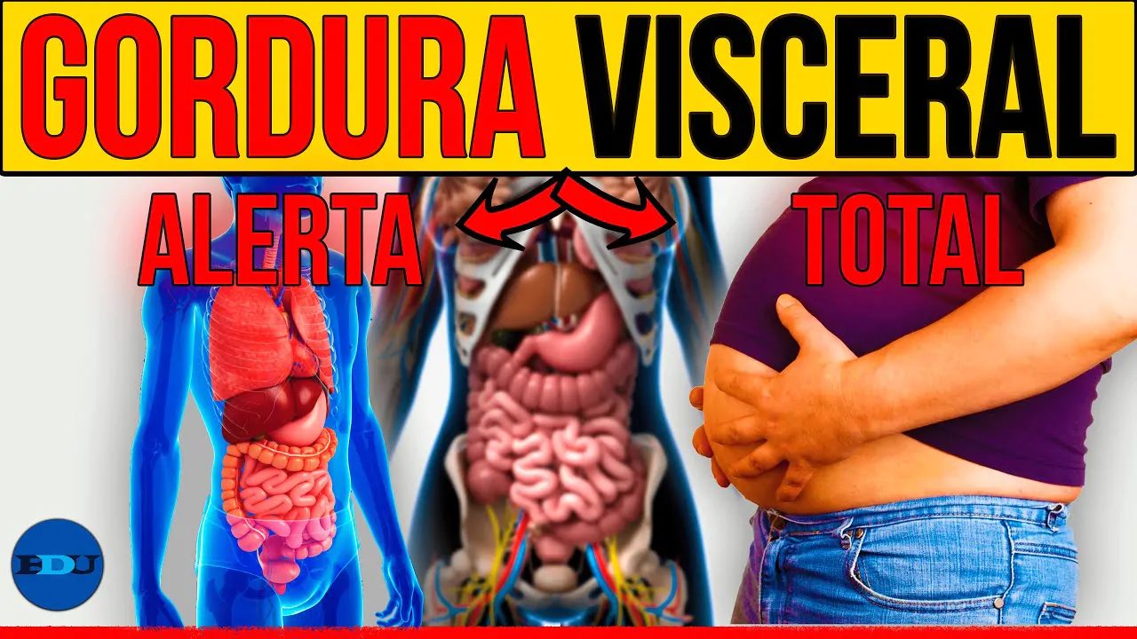 DIABETES TIPO 2: FALSO MAGRO E GORDURA VISCERAL