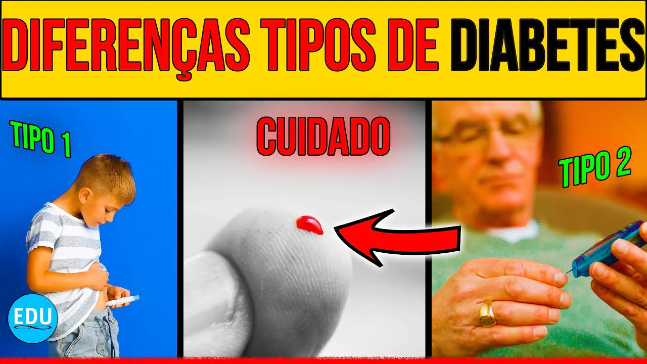 QUAL A DIFERENÇA ENTRE DIABETES TIPO 1 E TIPO 2? │ @EDUDiabetes