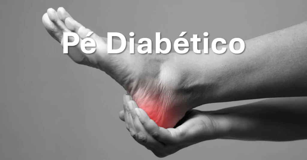 Pé diabético O artigo aborda o pé diabético, uma complicação comum em pessoas com diabetes, detalhando sintomas, como dor e inchaço nos pés, e fatores de risco, como má circulação e neuropatia. Enfatiza a importância de cuidados preventivos, como exames regulares, calçados adequados e alimentação balanceada. O tratamento para o pé diabético pode incluir medicamentos e, em casos severos, cirurgia. Manter a glicemia controlada e adotar uma dieta saudável com alimentos como batata inglesa e coenzima Q10 são essenciais para gerenciar a condição.