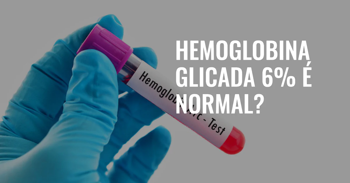 Hemoglobina Glicada 6 é normal? Este artigo explora se um nível de hemoglobina glicada de 6% é normal ou não. A análise abrange a interpretação dos resultados deste exame, o que significa para pessoas com ou sem diabetes, e recomendações para controle glicêmico eficaz.