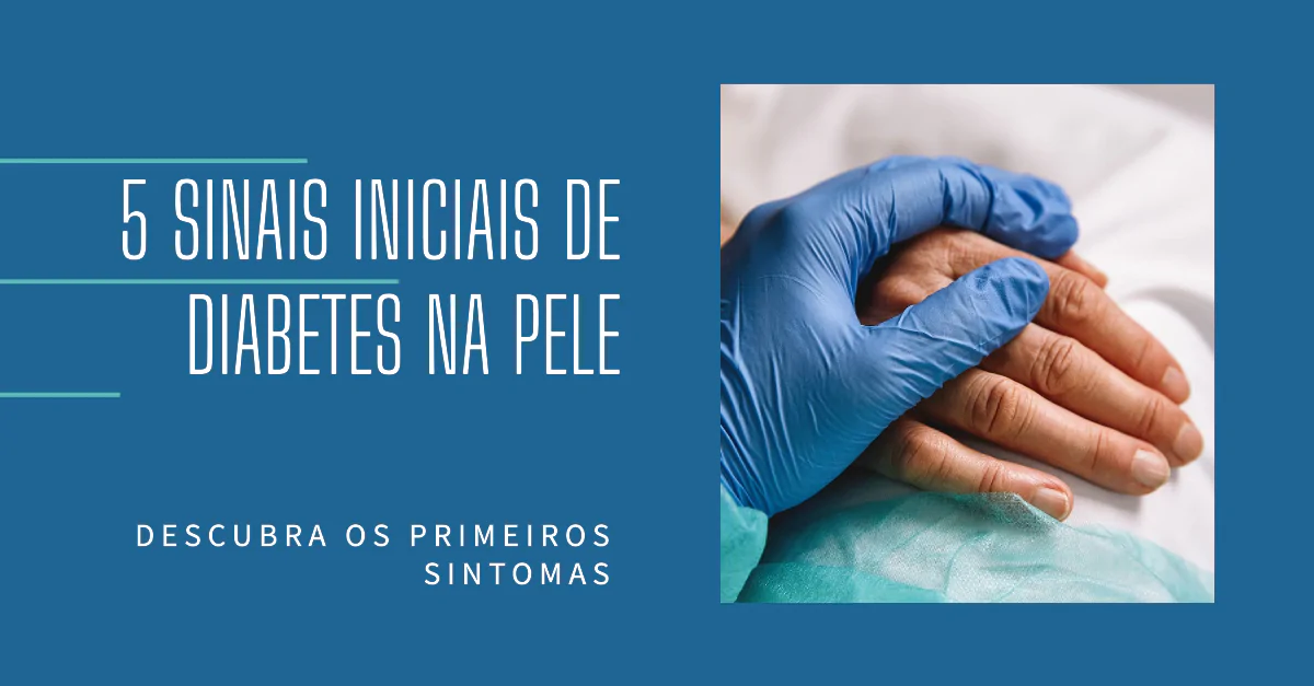 5 sinais iniciais de Diabetes na pele. Detectar precocemente os 5 sinais iniciais de diabetes na pele pode ser crucial para o diagnóstico e controle eficaz da condição. Este artigo explora sinais como ressecamento e coceira, manchas escuras, infecções frequentes, xantomas e necrobiose lipoídica, enfatizando a importância do cuidado preventivo e do tratamento adequado.