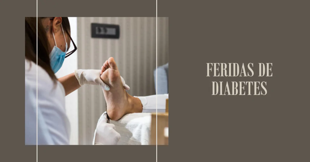 Feridas de Diabetes. Este artigo aborda os desafios enfrentados por diabéticos no tratamento de feridas, destacando a importância de um cuidado eficaz e a necessidade de monitoramento rigoroso. Exploramos as razões pelas quais as feridas não cicatrizam facilmente em pacientes com diabetes, como a má circulação e a neuropatia, e oferecemos orientações sobre prevenção e tratamento, incluindo medidas para manter a higiene adequada das feridas e uso de tecnologias avançadas. Também discutimos estratégias de prevenção eficazes, como o cuidado dos pés e o controle glicêmico, essenciais para evitar complicações graves.