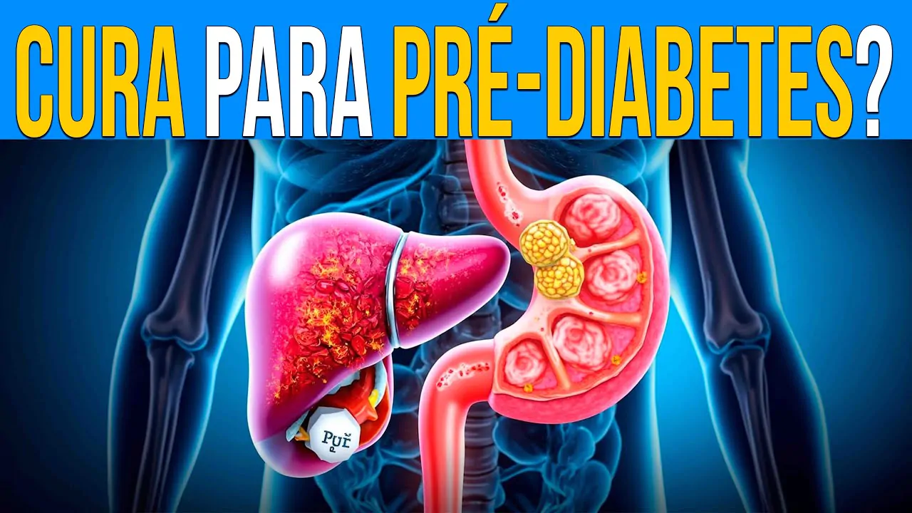 *CURA* DO PRÉ-DIABETES, COMO CONSEGUIR?